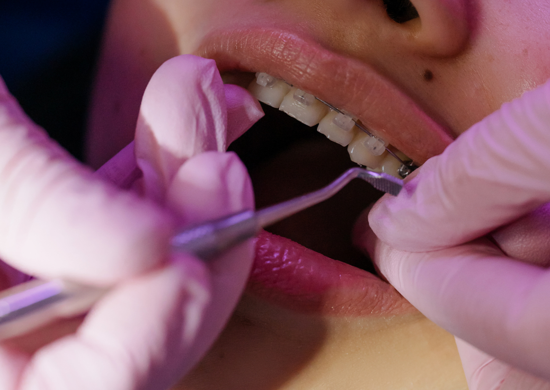 La historia de la ortodoncia | Asistencia Dental Especializada
